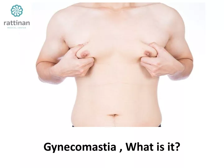 gynecomastia what is it