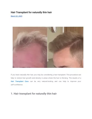 Hair Transplant for naturally thin hair