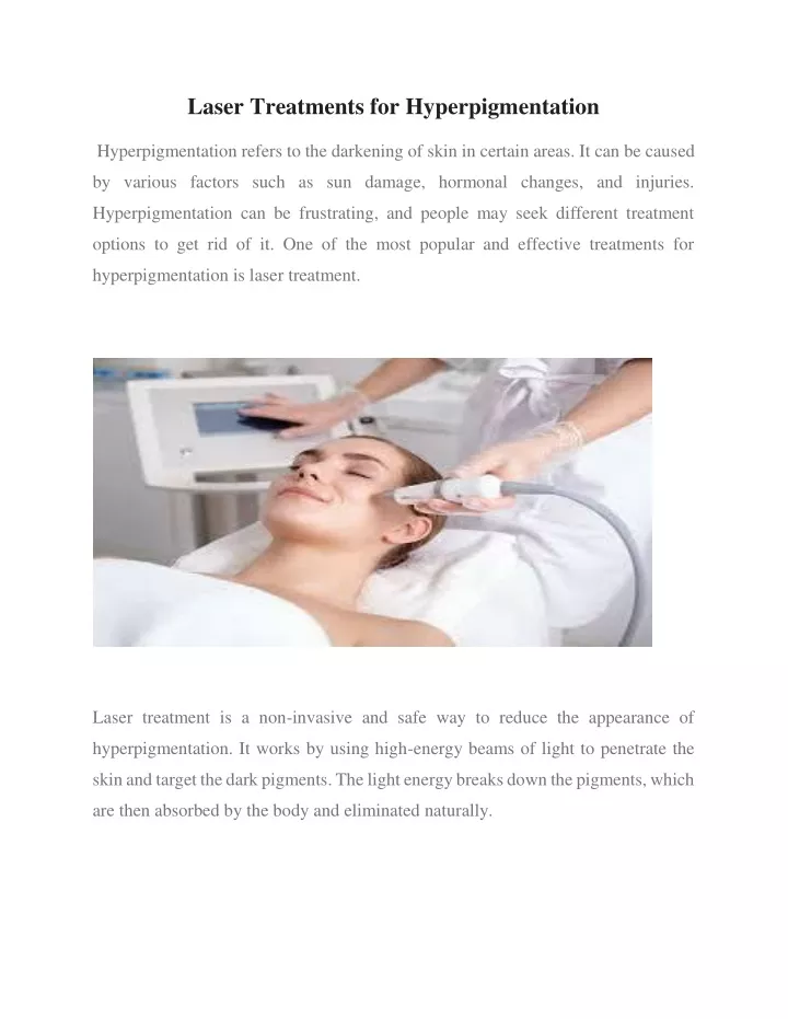 laser treatments for hyperpigmentation