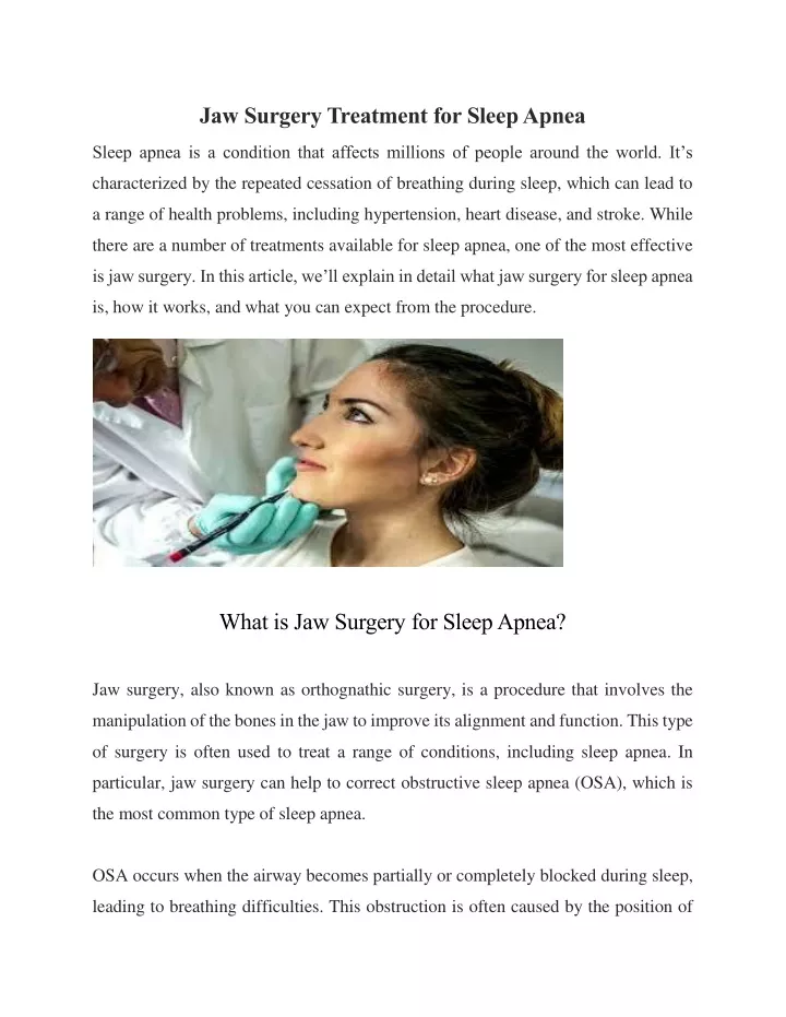 jaw surgery treatment for sleep apnea