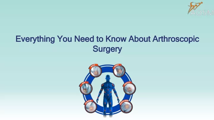 everything you need to know about arthroscopic surgery