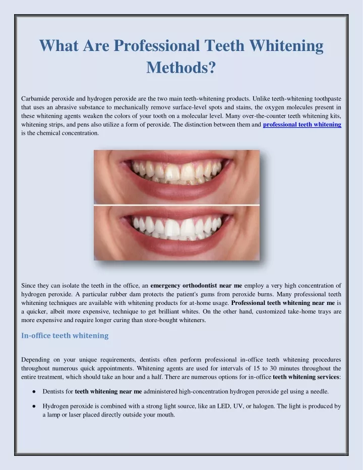 what are professional teeth whitening methods