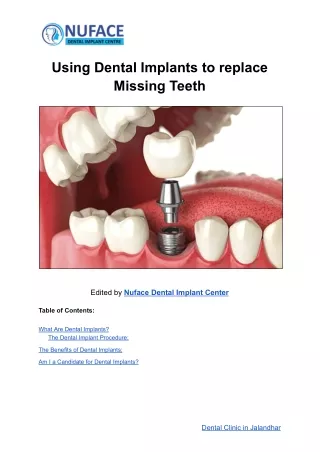Using dental implants to replace missing teeth