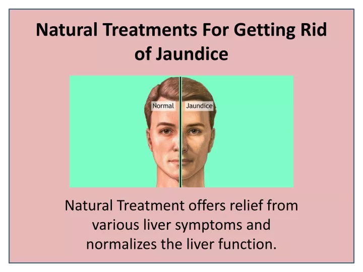 natural treatments for getting rid of jaundice