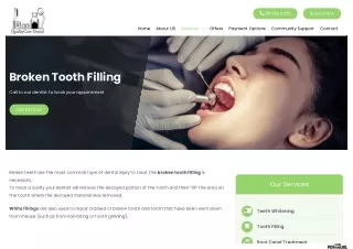 Affordable White Tooth Fillings In Auckland