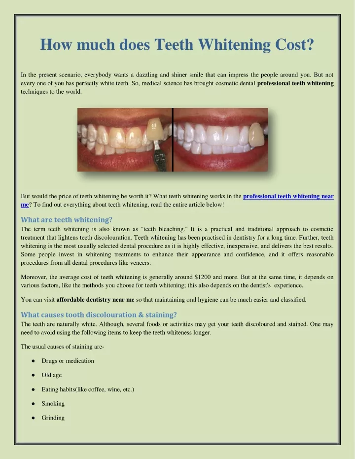 how much does teeth whitening cost