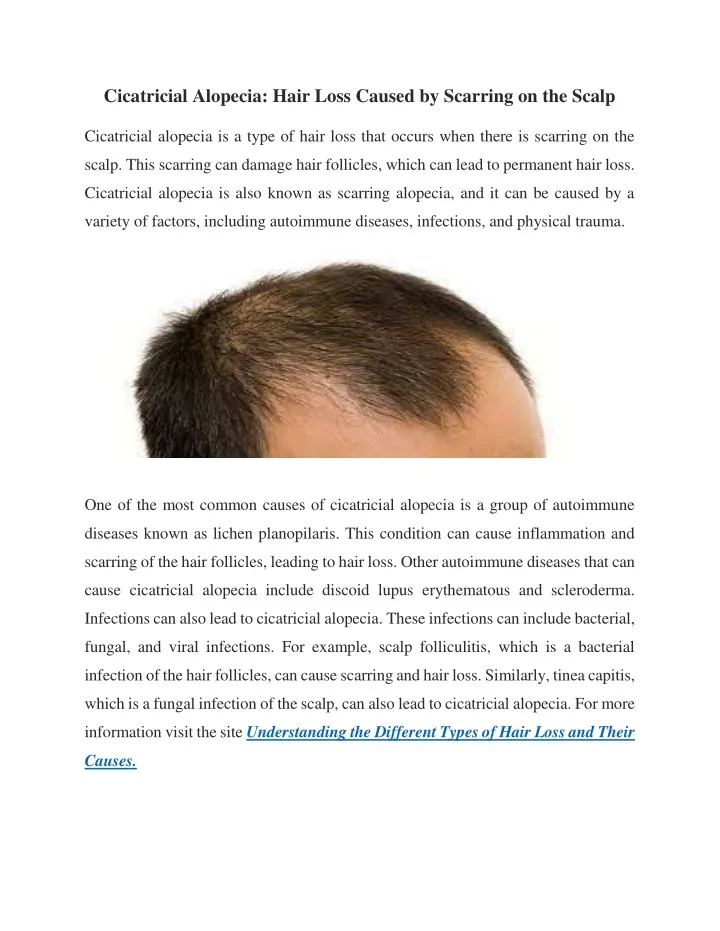 cicatricial alopecia hair loss caused by scarring