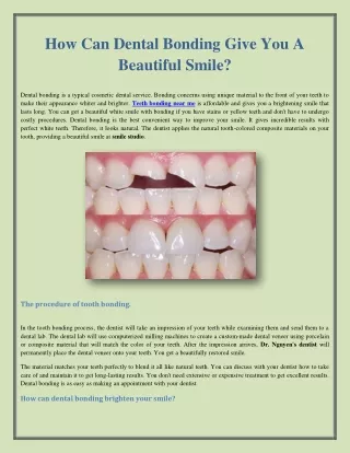 How Can Dental Bonding Give You A Beautiful Smile?