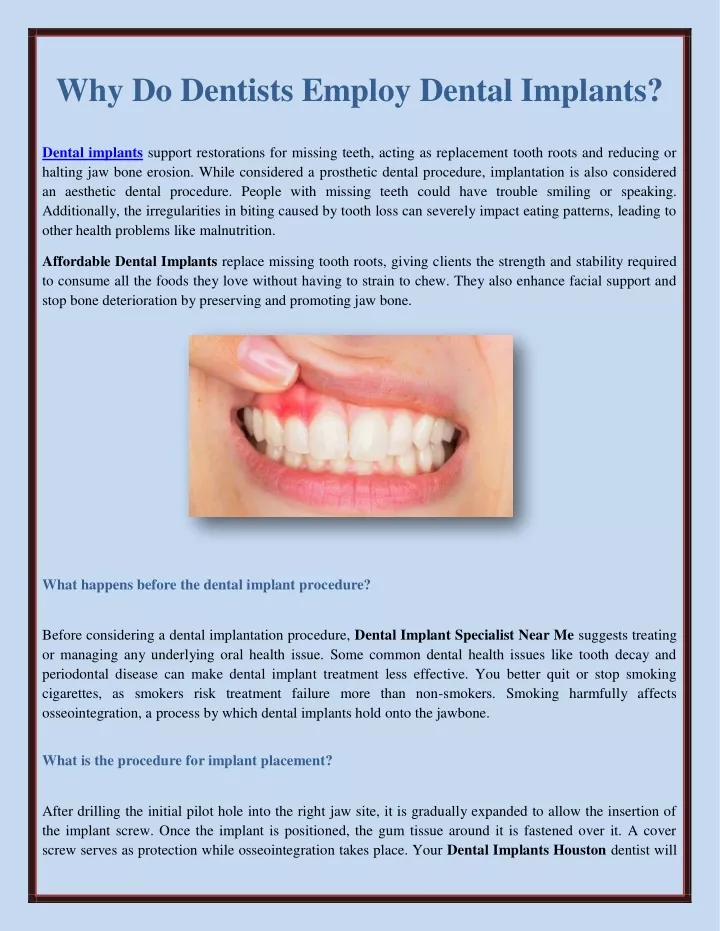 why do dentists employ dental implants