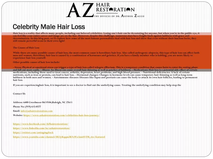 celebrity male hair loss