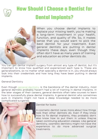 How Should I Choose a Dentist for Dental Implants