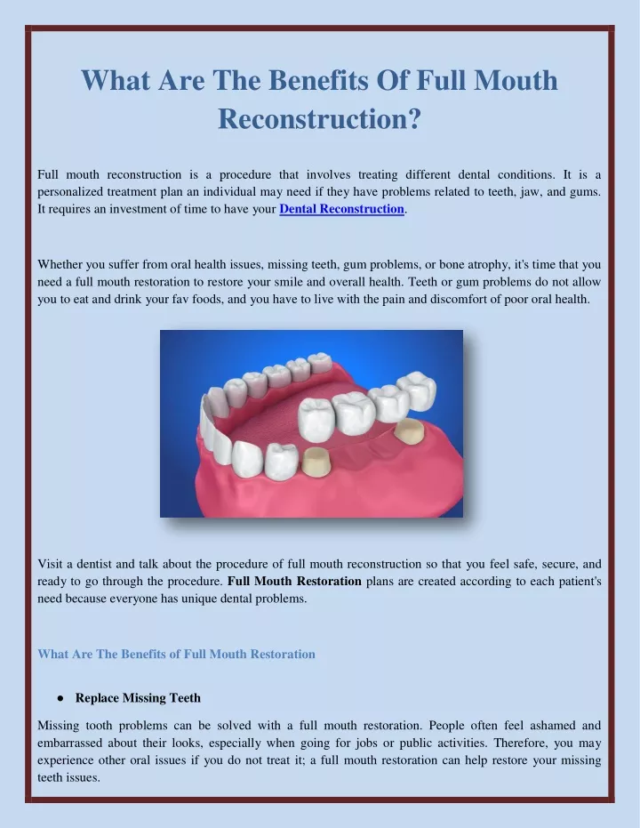 what are the benefits of full mouth reconstruction
