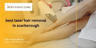 best laser hair removal in scarborough