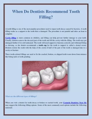 When Do Dentists Recommend Tooth Filling?