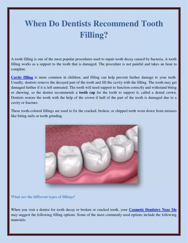when do dentists recommend tooth filling