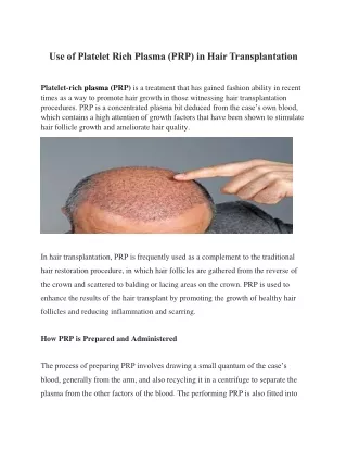 use of platelet rich plasma prp in hair
