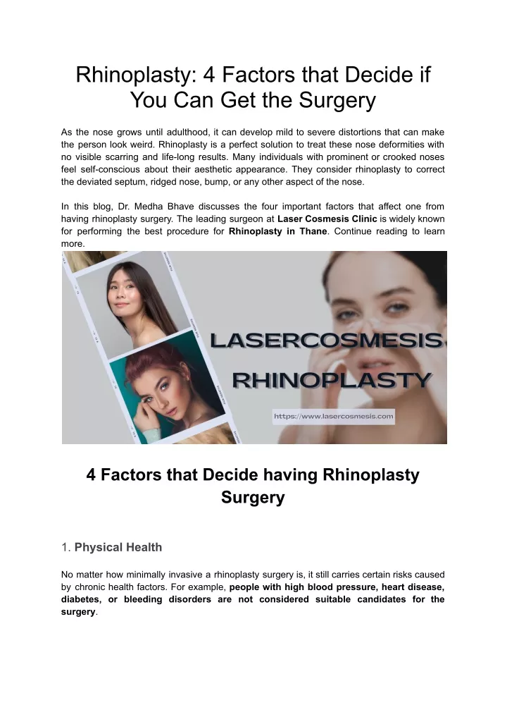 rhinoplasty 4 factors that decide