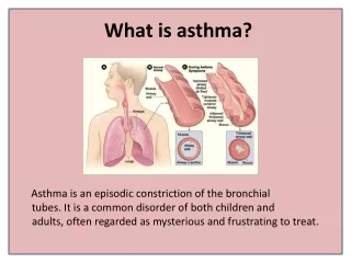 Get Asthma Relief Naturally without Drugs or Inhalers