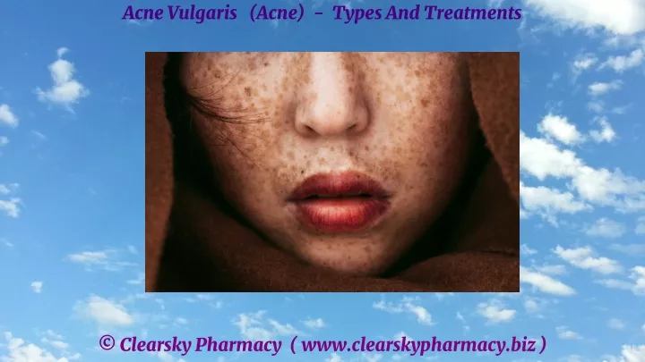 acne vulgaris acne types and treatments