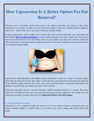 How Liposuction Is A Better Option For Fat Removal?