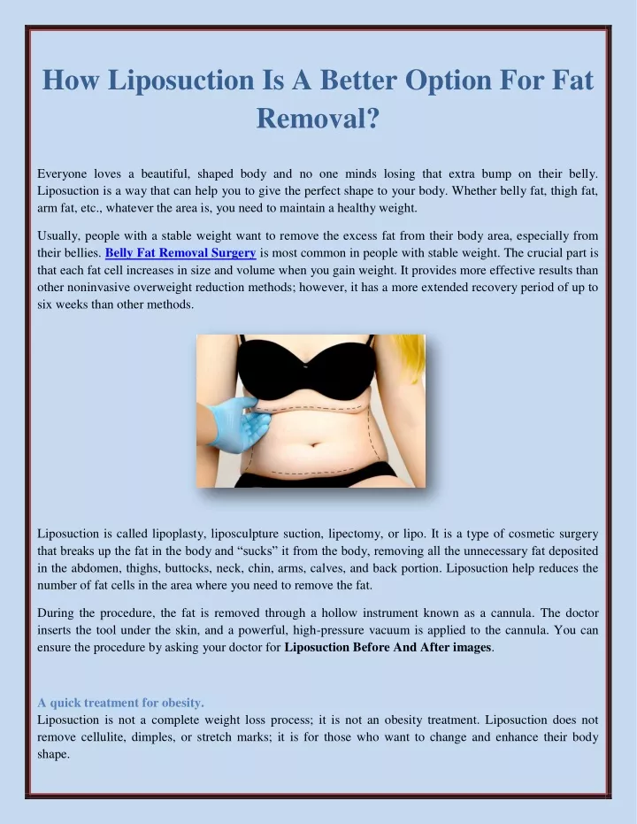 how liposuction is a better option for fat removal