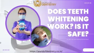 DOES TEETH WHITENING WORK? IS IT SAFE?