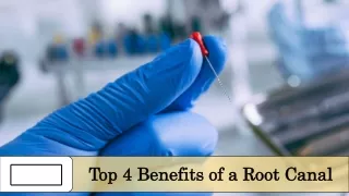 Root Canals: Not as Scary as You Think! Top 4 Benefits Revealed