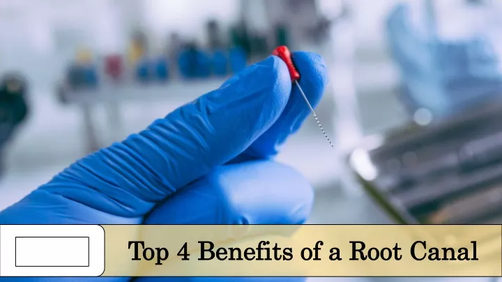 top 4 benefits of a root canal