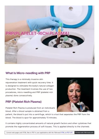 prp platelet rich plasma prp platelet rich plasma