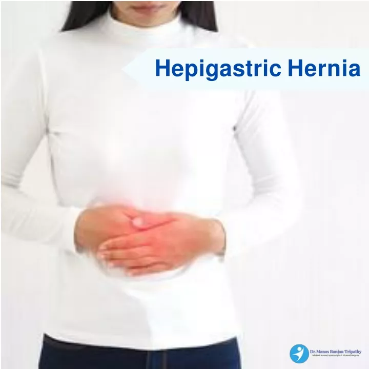 hepigastric hernia