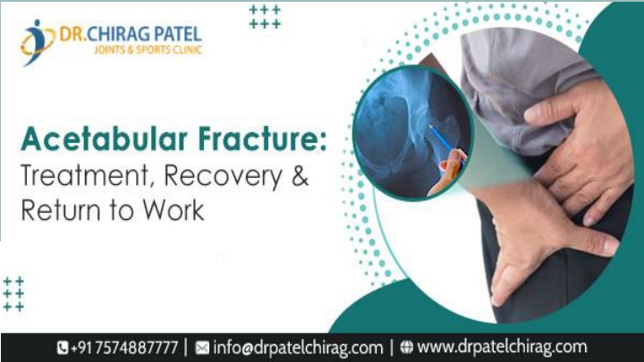 PPT - Acetabular Fracture Treatment, Recovery & Return to Work ...