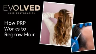 How PRP Works to Regrow Hair
