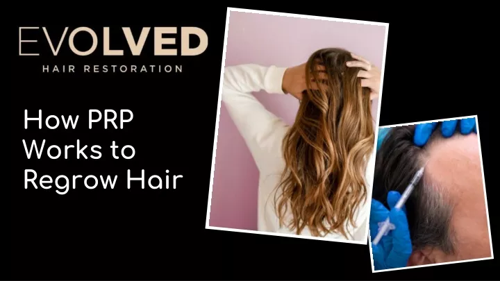 how prp works to regrow hair