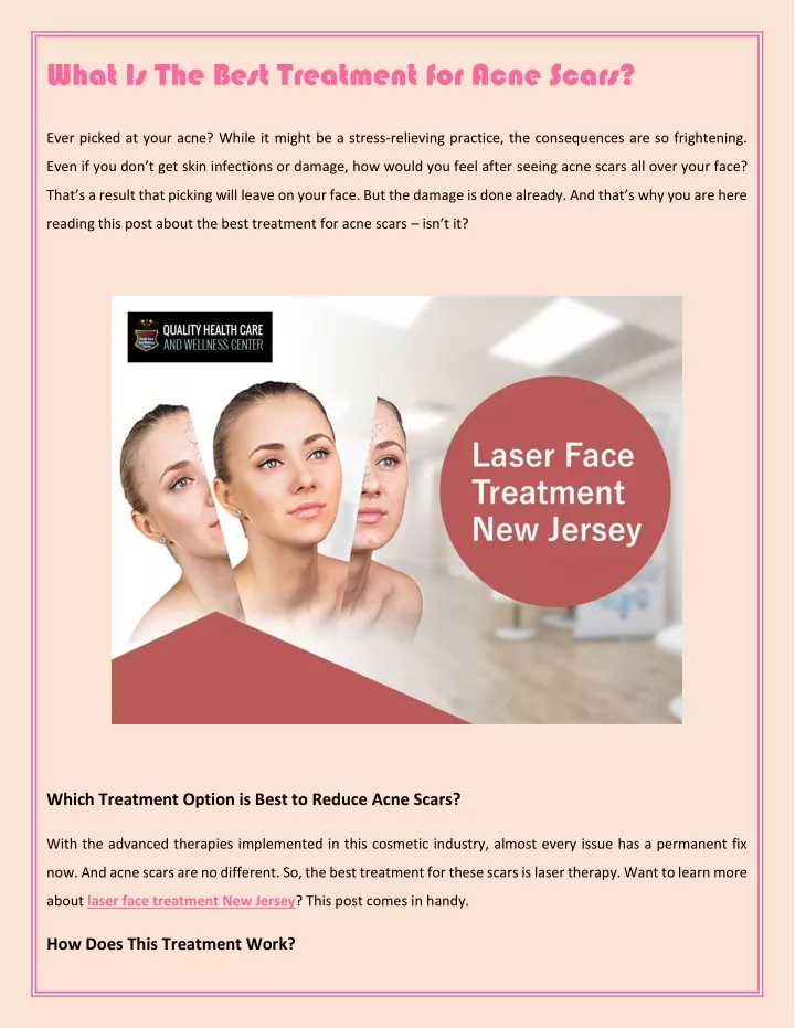 what is the best treatment for acne scars