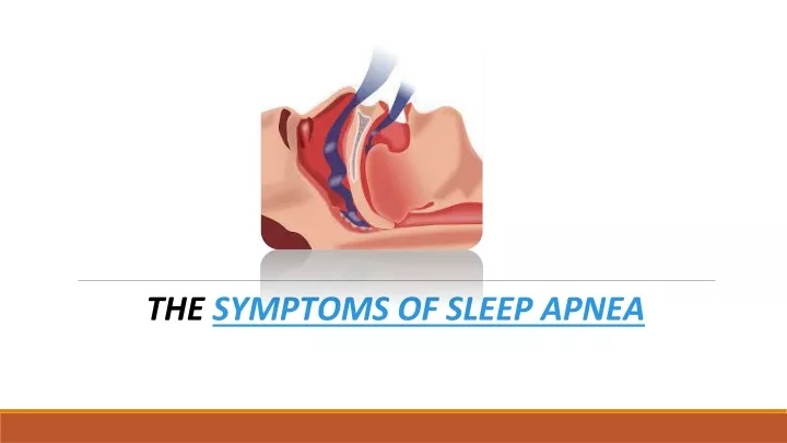 the symptoms of sleep apnea