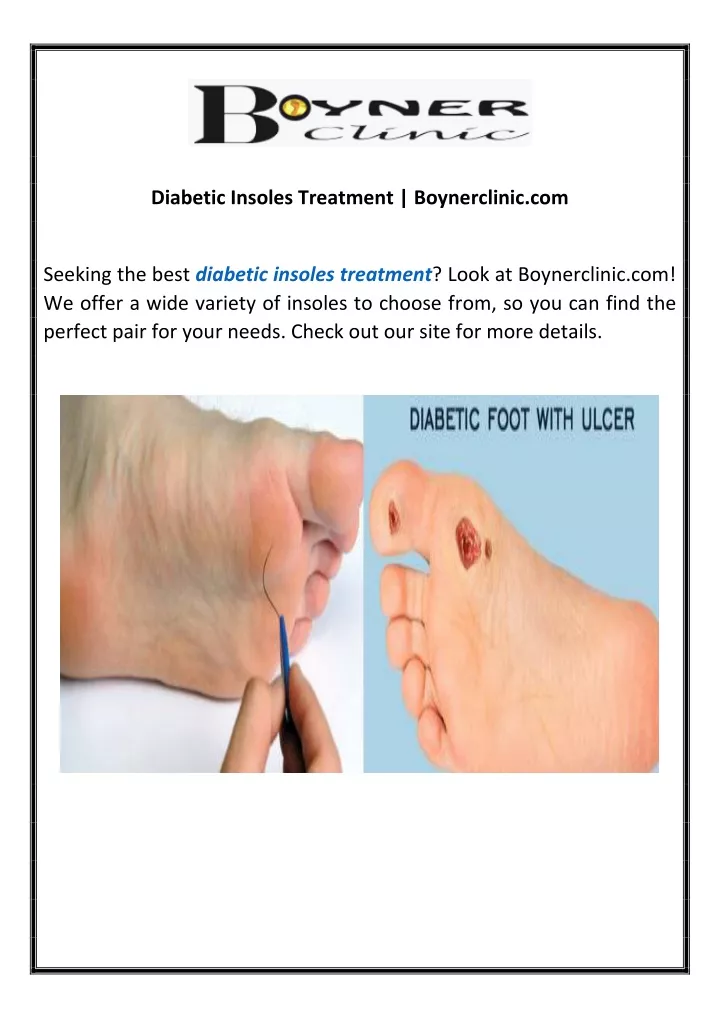 diabetic insoles treatment boynerclinic com