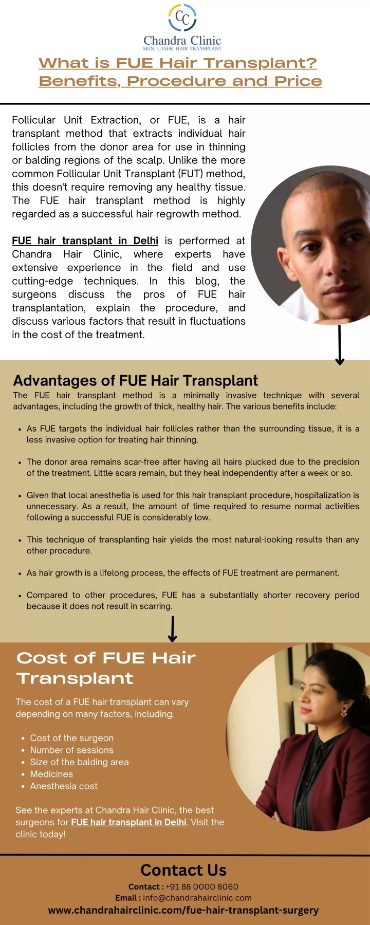 what is fue hair transplant benefits procedure