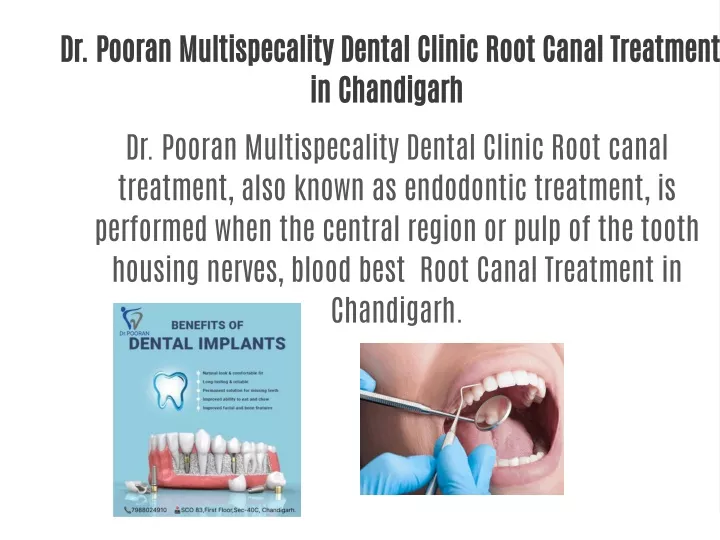 dr pooran multispecality dental clinic root canal