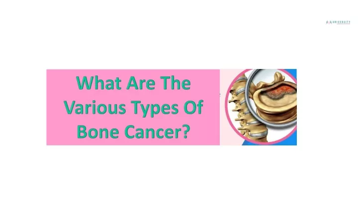 what are the various types of bone cancer