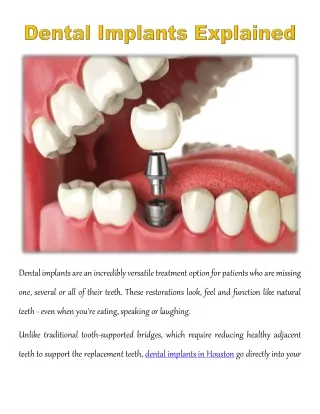 dental implants are an incredibly versatile