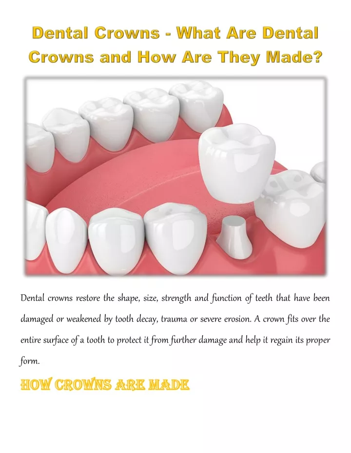 dental crowns restore the shape size strength