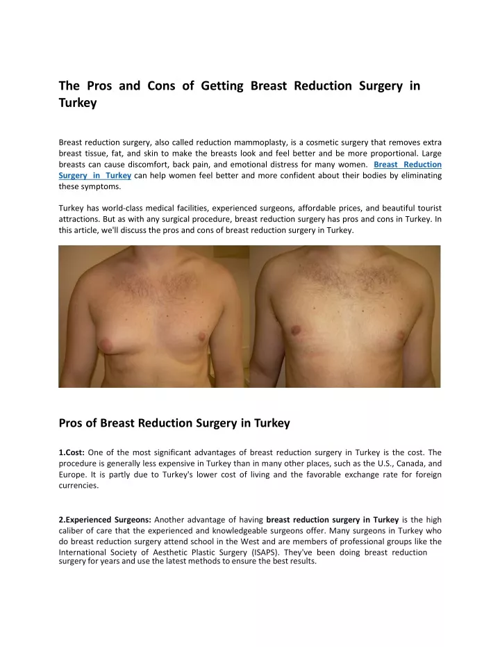 the pros and cons of getting breast reduction