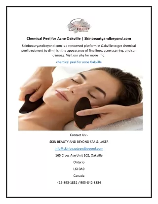 Chemical Peel for Acne Oakville  Skinbeautyandbeyond.com