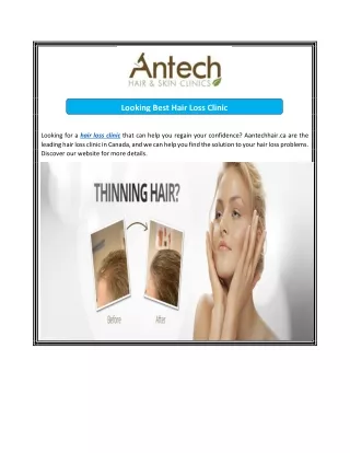 Looking Best Hair Loss Clinic