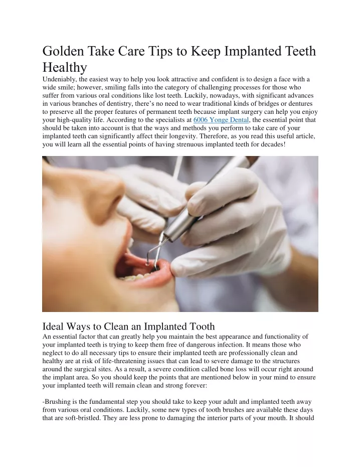 golden take care tips to keep implanted teeth