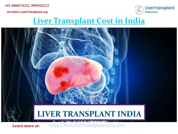 PPT - More About Liver transplant cost in India PowerPoint Presentation ...