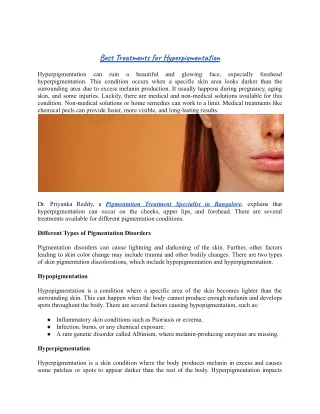 Hyperpigmentation can ruin a beautiful and glowing face, especially forehead hyp