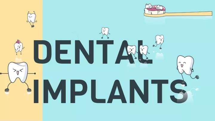 dental implants