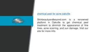 Chemical Peel for Acne Oakville  Skinbeautyandbeyond.com