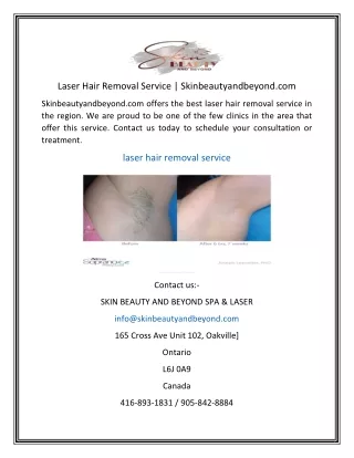 Laser Hair Removal Service | Skinbeautyandbeyond.com